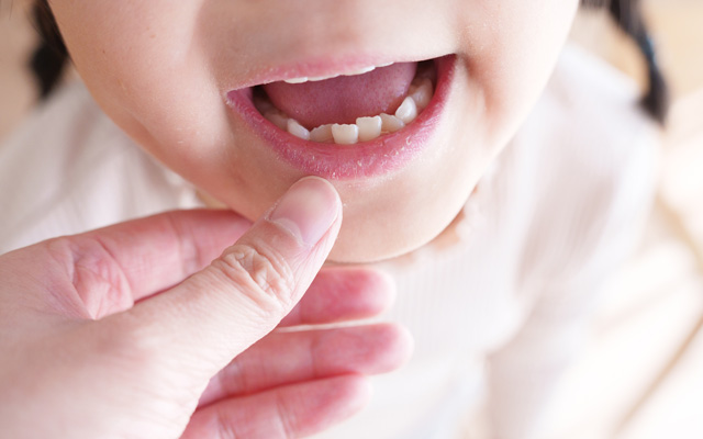 プレオルソの写真