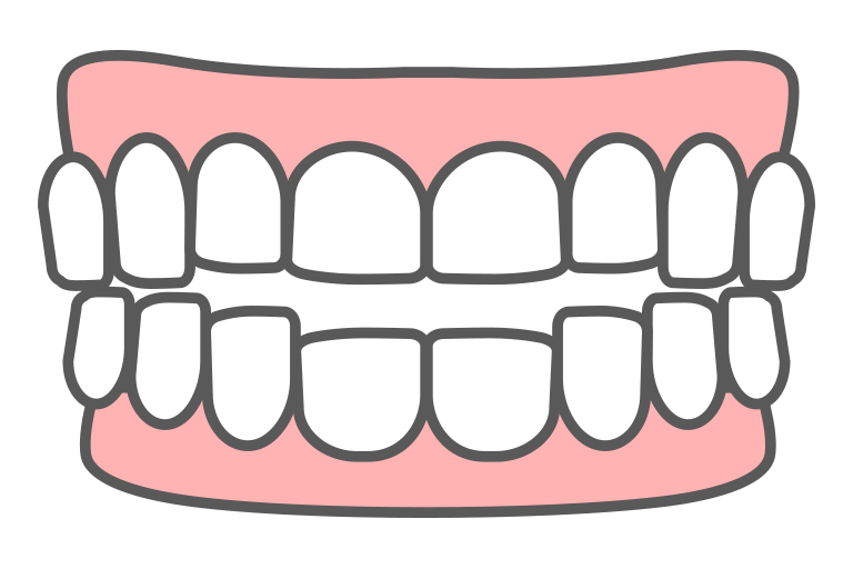 開咬のイラスト