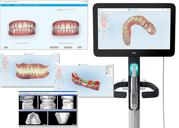 スキャンのイメージ