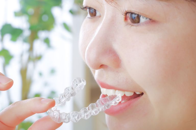 Ⅱ期矯正治療の写真